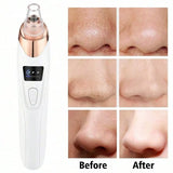 Electric Facial Skin Care Pore Removal Cleanser Vacuum Acne Removal for Deep Facial Pores 5 Suction Power Blackhead Remover Pore