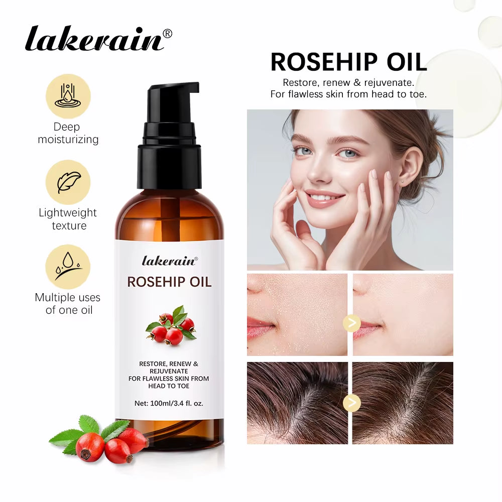 Organic Rosehip Oil Rose Hips Face Oils 30Ml Fast-Absorbing for Anti-Aging Scar Treatment Skin Care Moisturizer Face Oil