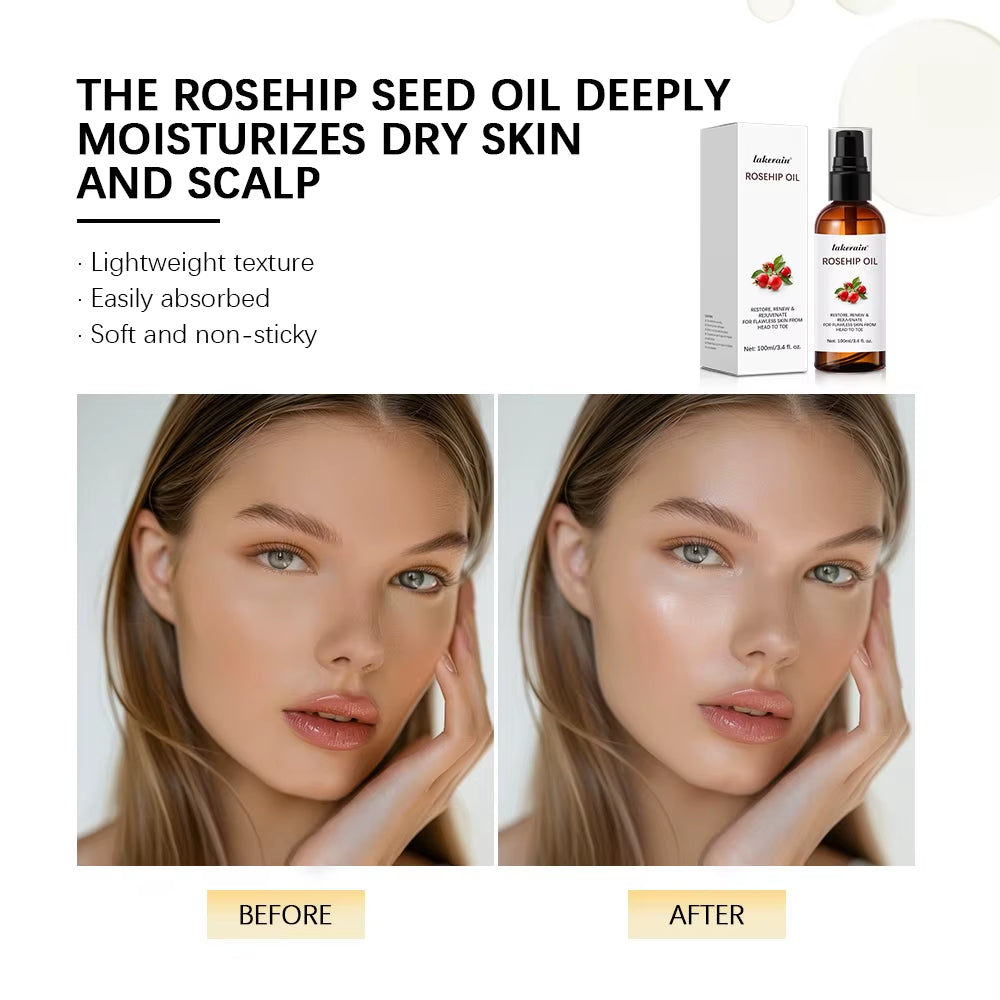 Organic Rosehip Oil Rose Hips Face Oils 30Ml Fast-Absorbing for Anti-Aging Scar Treatment Skin Care Moisturizer Face Oil