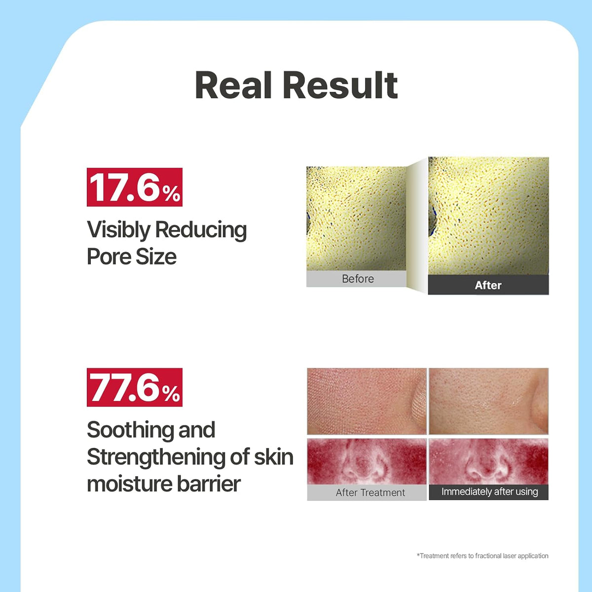 Ceramide Ato Concentrate Gel Face Mask | 34G X 4Ea, Ceramide & Collagen Hydrating Overnight Hydrogel Mask with Hyaluronic Acid, Korean Pore Tightening Sleep Mask, Glass Skin Glow