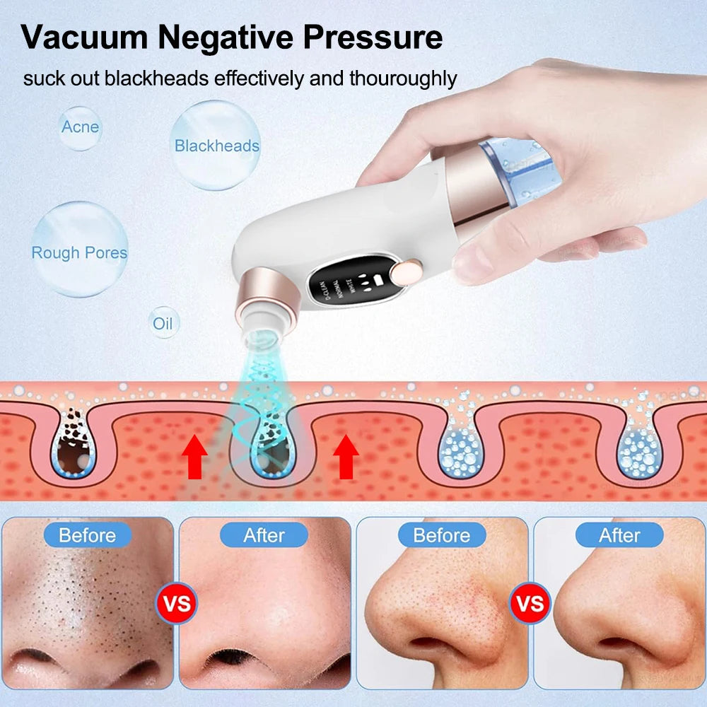 Blackhead Remover Pore Vacuum Suction Face Cleaner USB Rechargeable Comedone Acne Black Head Removal Facial Black Dot Extractor