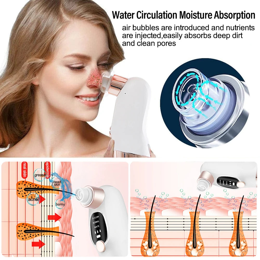 Blackhead Remover Pore Vacuum Suction Face Cleaner USB Rechargeable Comedone Acne Black Head Removal Facial Black Dot Extractor