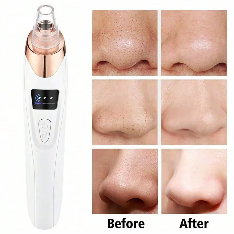 Electric Facial Skin Care Pore Removal Cleanser Vacuum Acne Removal for Deep Facial Pores 5 Suction Power Blackhead Remover Pore
