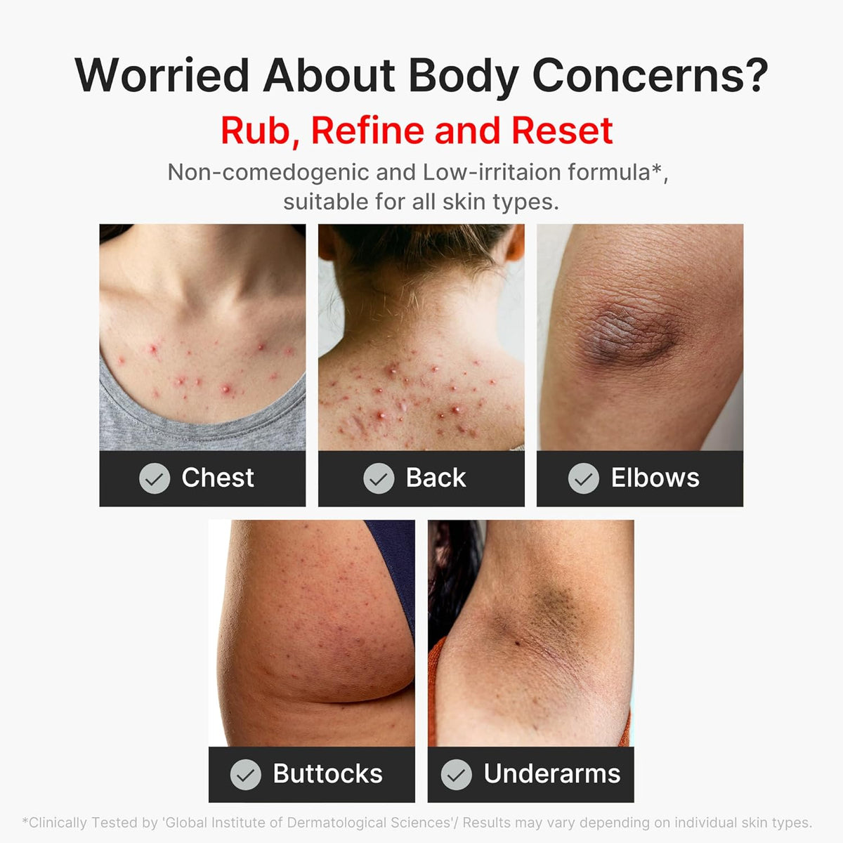 Body Peel Shot Duo - Hypochlorous Acid & Kojic Acid Body Peel Shot