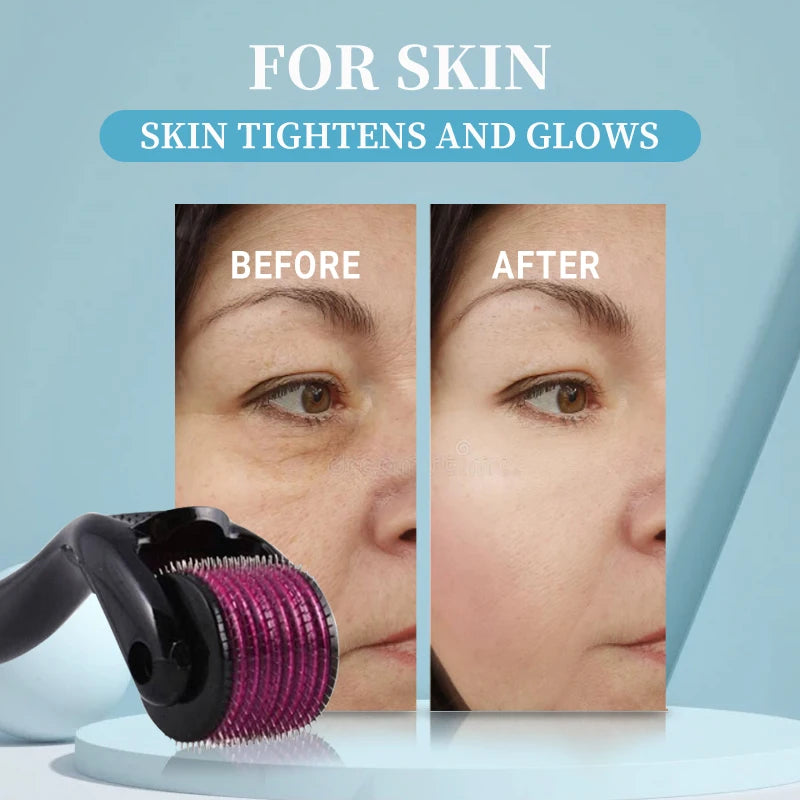 Micro Needling 540 Roller Derma Roller Professional Titanium Dermaroller 0.2/0.25/0.3Mm Hair Regrowth Beard Growth Treatment